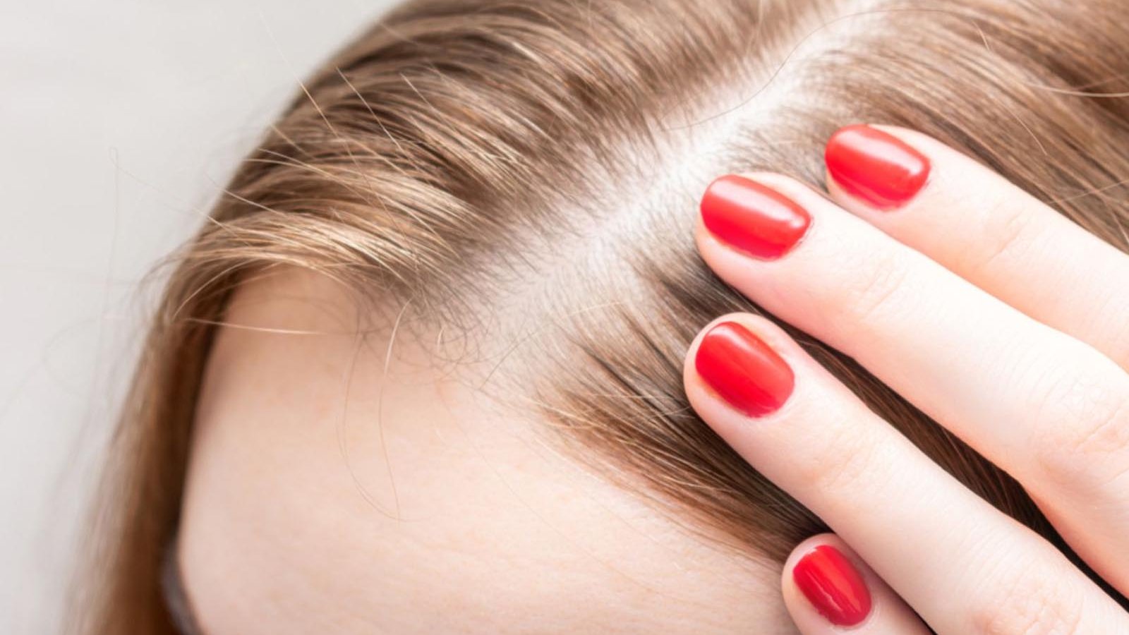 Frauen-Haarausfall behandeln – Spezialisierte Therapie in Schweiz